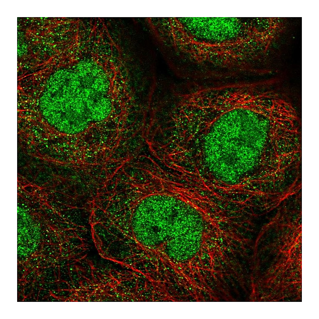 Atlas Antibodies Anti-ANKRD11 Antibody