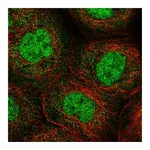Atlas Antibodies Anti-ANKRD11 Antibody
