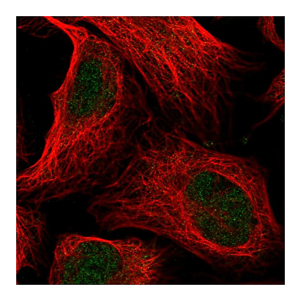 Atlas Antibodies Anti-ANKRD11 Antibody