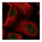 Atlas Antibodies Anti-ANKRD11 Antibody