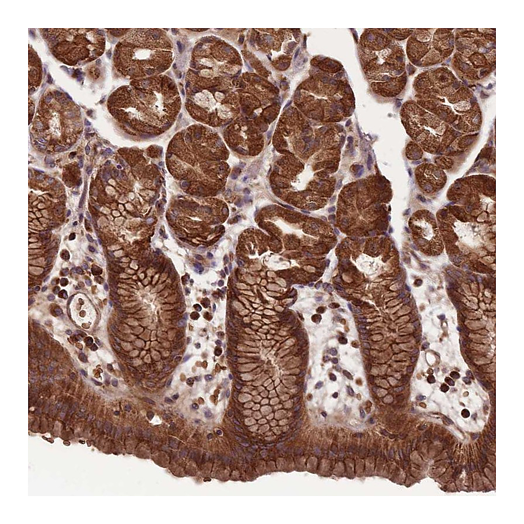 Atlas Antibodies Anti-ANKRD10 Antibody