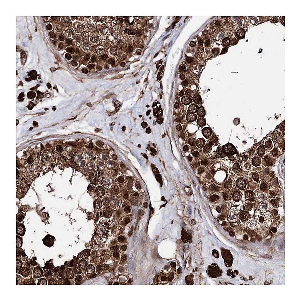 Atlas Antibodies Anti-ANKRD12 Antibody