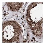 Atlas Antibodies Anti-ANKRD12 Antibody