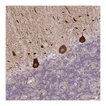 Atlas Antibodies Anti-ANKRD10 Antibody