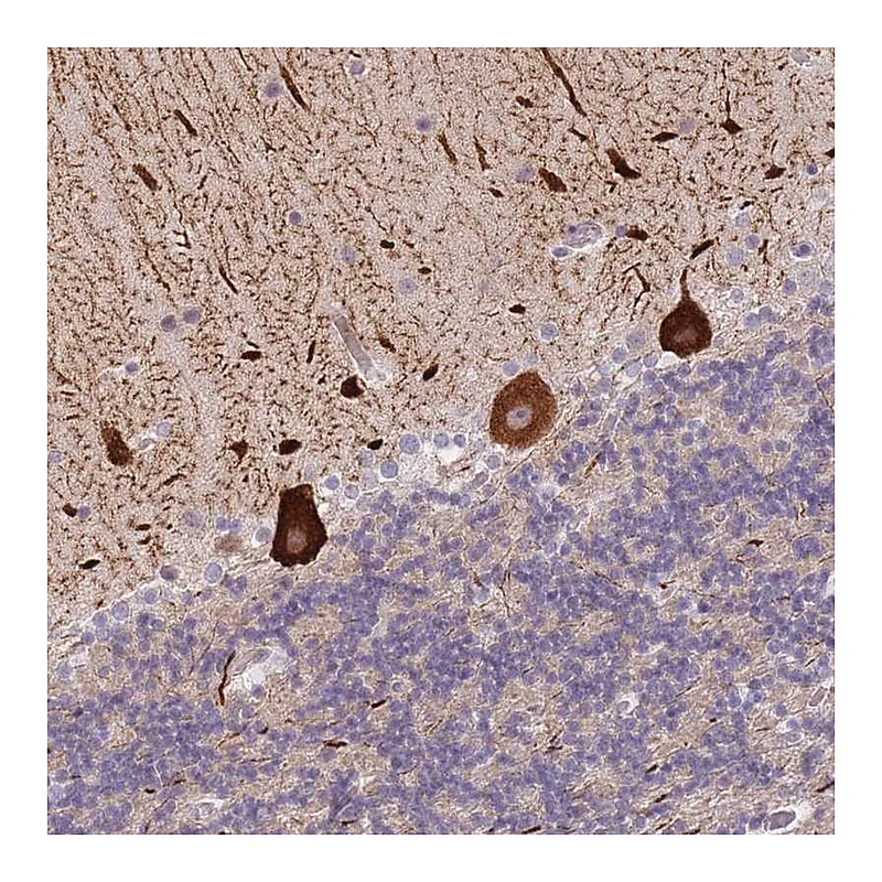 Atlas Antibodies Anti-ANKRD10 Antibody