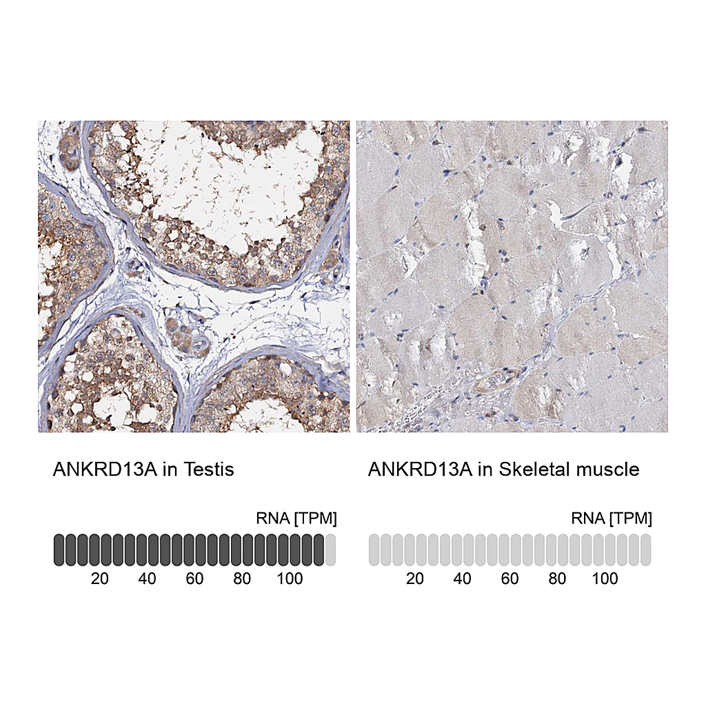 Atlas Antibodies Anti-ANKRD13A Antibody