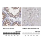 Atlas Antibodies Anti-ANKRD13A Antibody