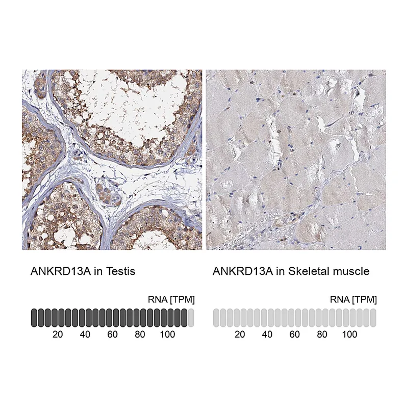 Atlas Antibodies Anti-ANKRD13A Antibody