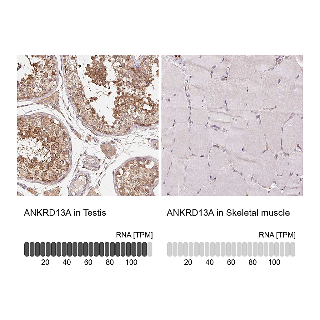 Atlas Antibodies Anti-ANKRD13A Antibody