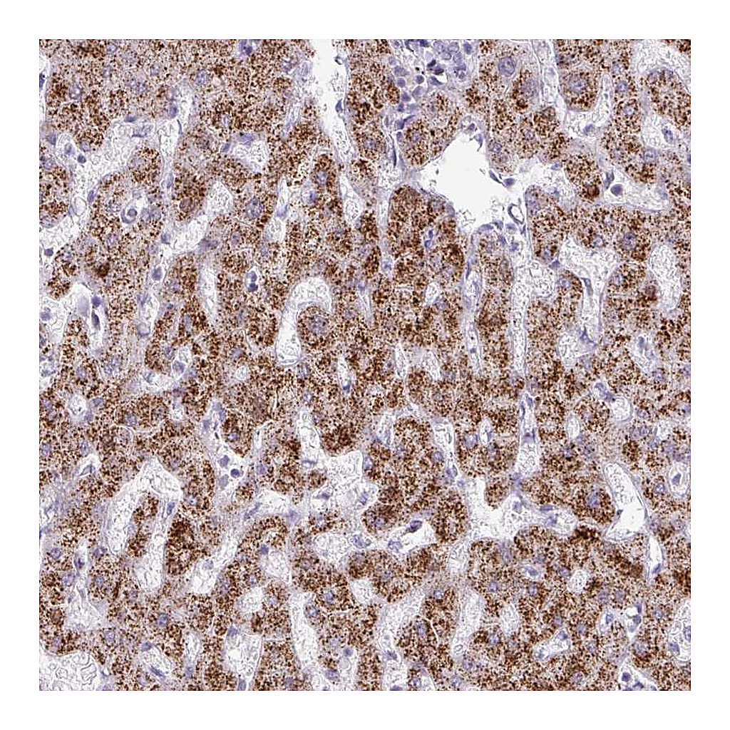 Atlas Antibodies Anti-ANKRD13B Antibody