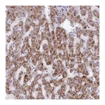 Atlas Antibodies Anti-ANKRD13B Antibody