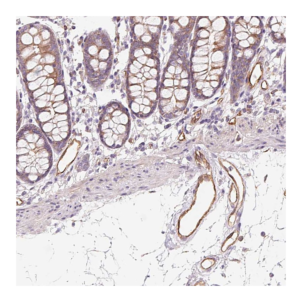 Atlas Antibodies Anti-ANKRD13B Antibody