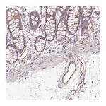 Atlas Antibodies Anti-ANKRD13B Antibody