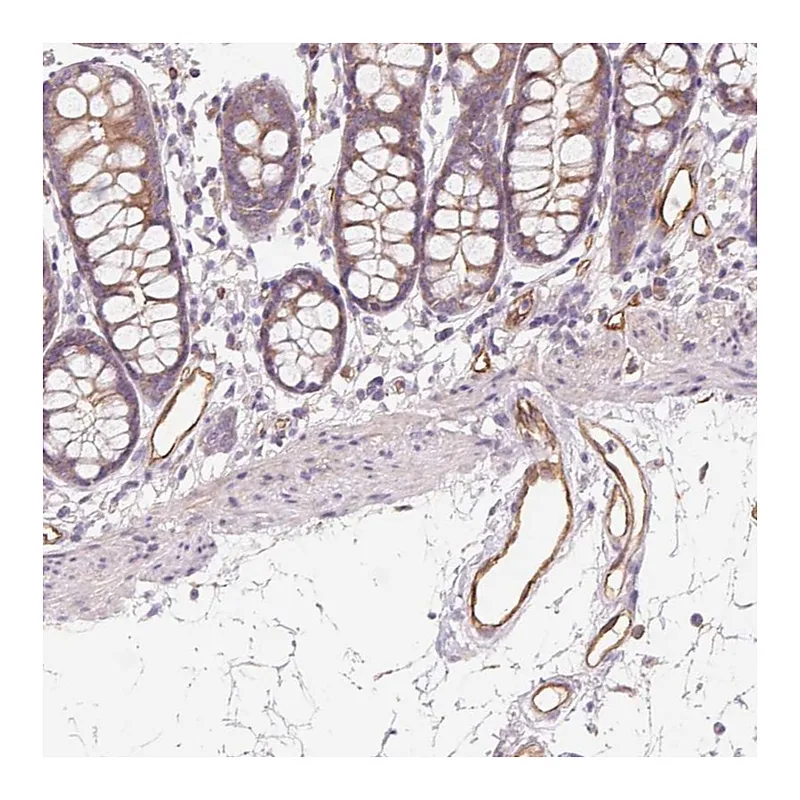 Atlas Antibodies Anti-ANKRD13B Antibody