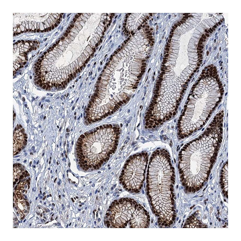 Atlas Antibodies Anti-ANKRD13D Antibody