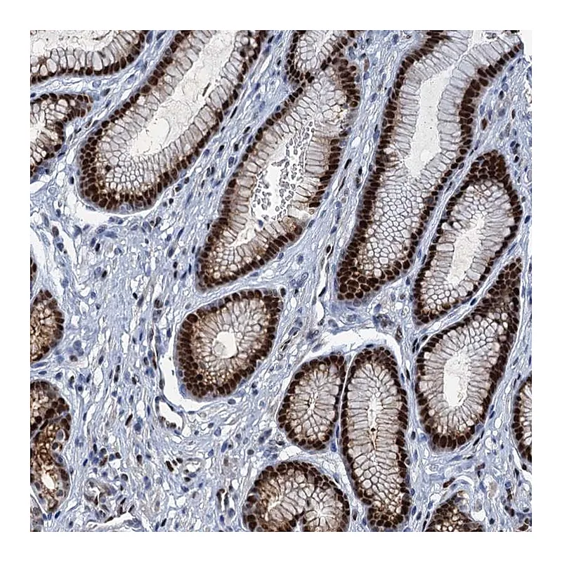 Atlas Antibodies Anti-ANKRD13D Antibody