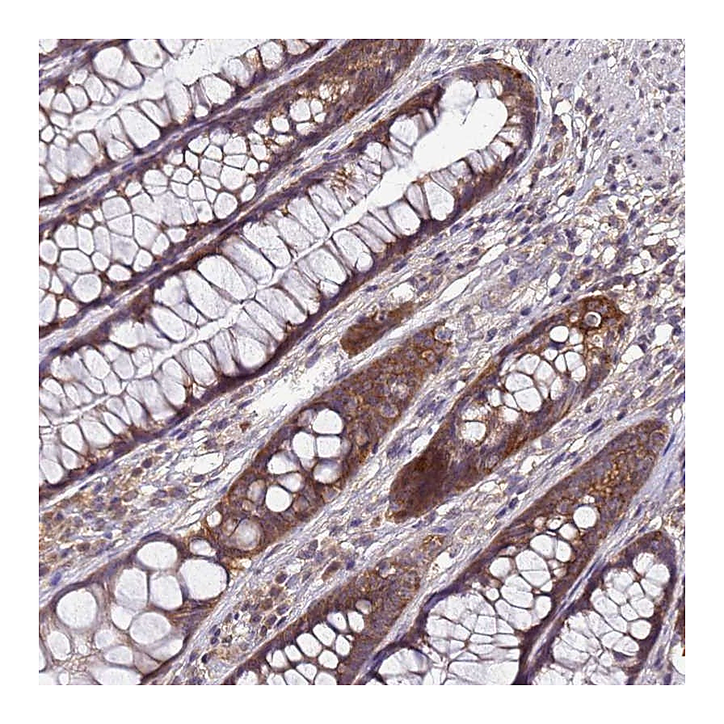 Atlas Antibodies Anti-ANKRD17 Antibody