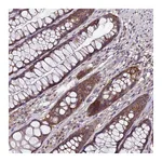 Atlas Antibodies Anti-ANKRD17 Antibody