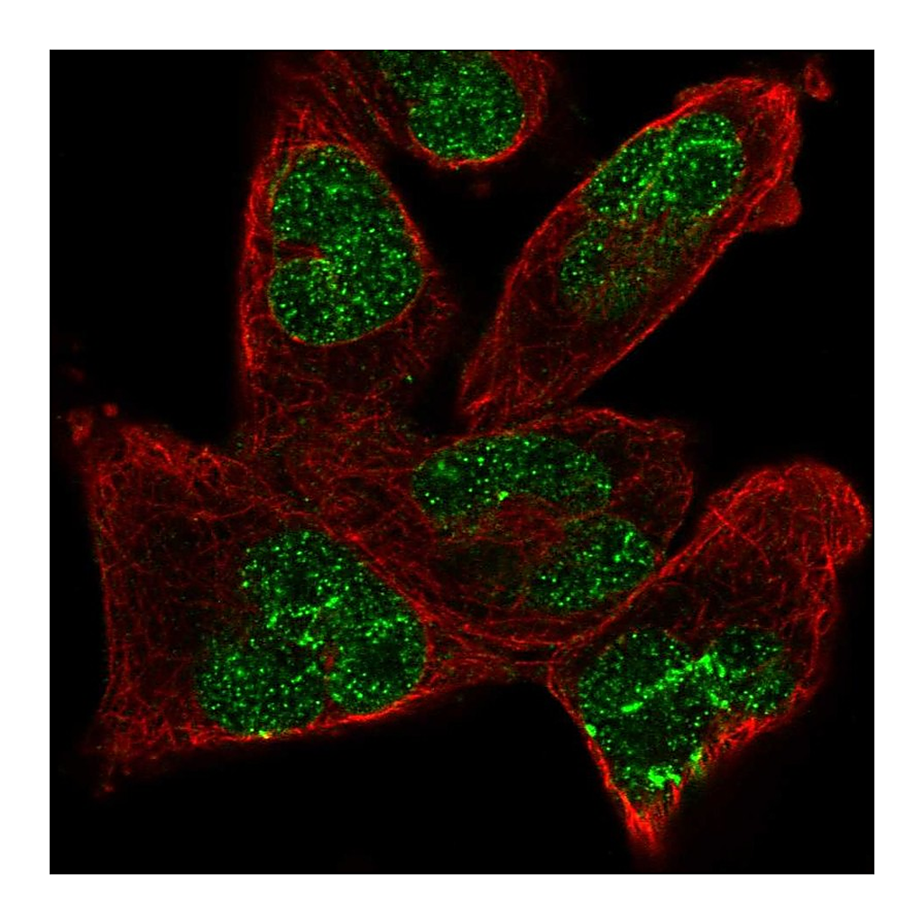 Atlas Antibodies Anti-ANKRD17 Antibody