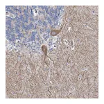 Atlas Antibodies Anti-ANKRD16 Antibody