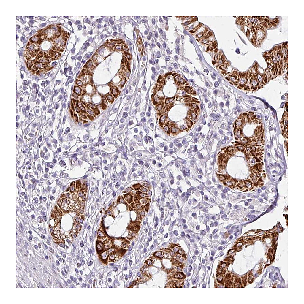 Atlas Antibodies Anti-ANKRD18A Antibody