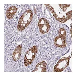Atlas Antibodies Anti-ANKRD18A Antibody