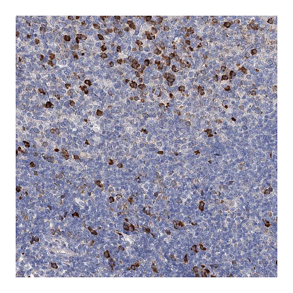 Atlas Antibodies Anti-ANKRD16 Antibody