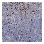Atlas Antibodies Anti-ANKRD16 Antibody