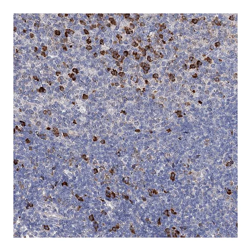 Atlas Antibodies Anti-ANKRD16 Antibody
