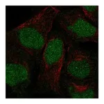 Atlas Antibodies Anti-ANKRD20A3P Antibody