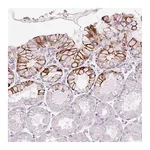 Atlas Antibodies Anti-ANKRD20A4 Antibody