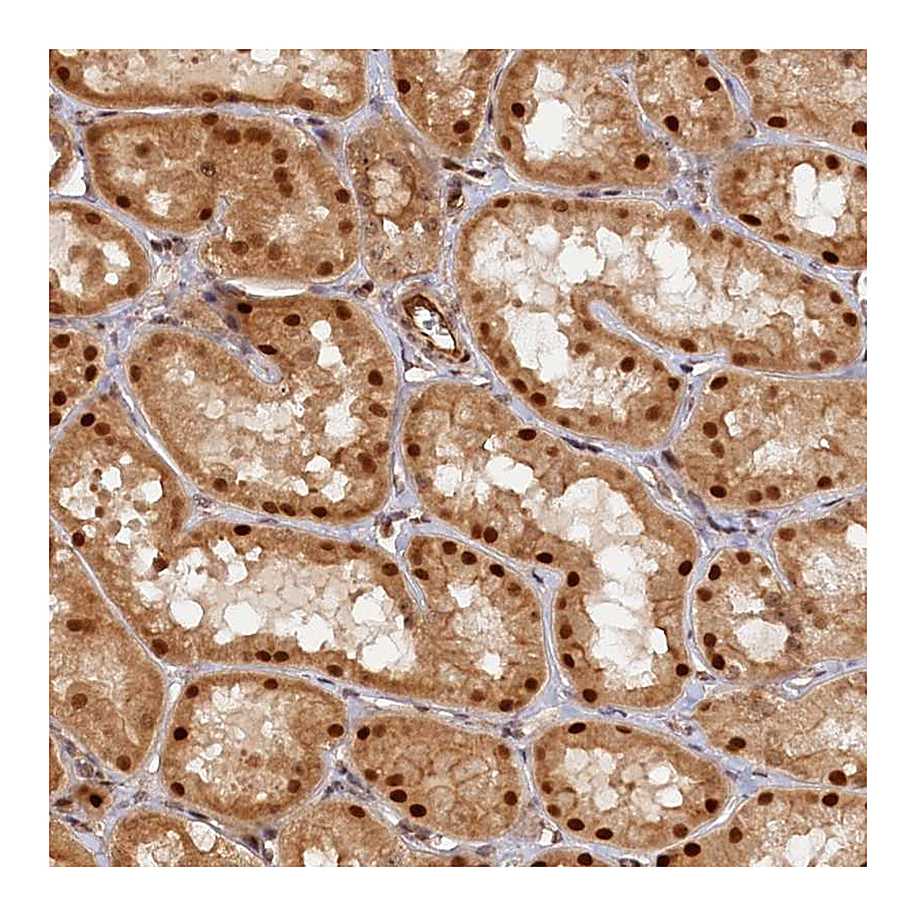 Atlas Antibodies Anti-ANKRD24 Antibody