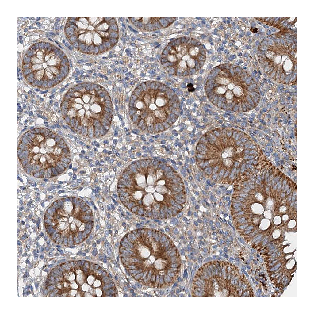 Atlas Antibodies Anti-ANKRD26 Antibody