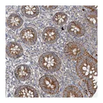 Atlas Antibodies Anti-ANKRD26 Antibody
