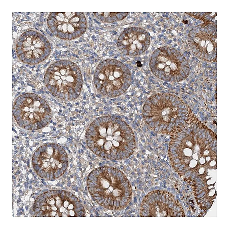 Atlas Antibodies Anti-ANKRD26 Antibody