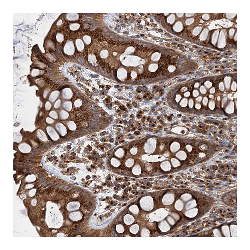 Atlas Antibodies Anti-ANKRD26 Antibody