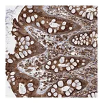 Atlas Antibodies Anti-ANKRD26 Antibody