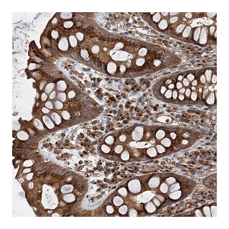Atlas Antibodies Anti-ANKRD26 Antibody