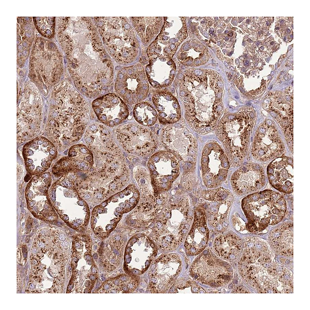 Atlas Antibodies Anti-ANKRD24 Antibody