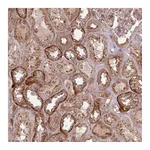 Atlas Antibodies Anti-ANKRD24 Antibody