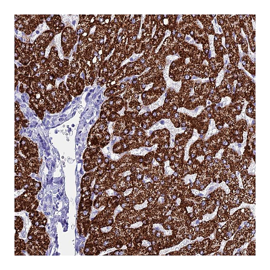Atlas Antibodies Anti-ANKRD29 Antibody