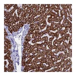 Atlas Antibodies Anti-ANKRD29 Antibody
