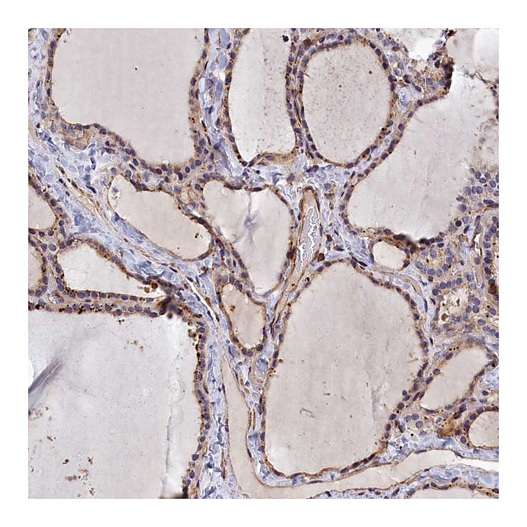 Atlas Antibodies Anti-ANKRD27 Antibody