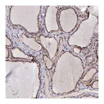 Atlas Antibodies Anti-ANKRD27 Antibody