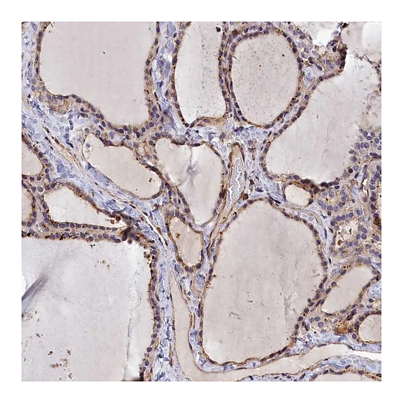 Atlas Antibodies Anti-ANKRD27 Antibody