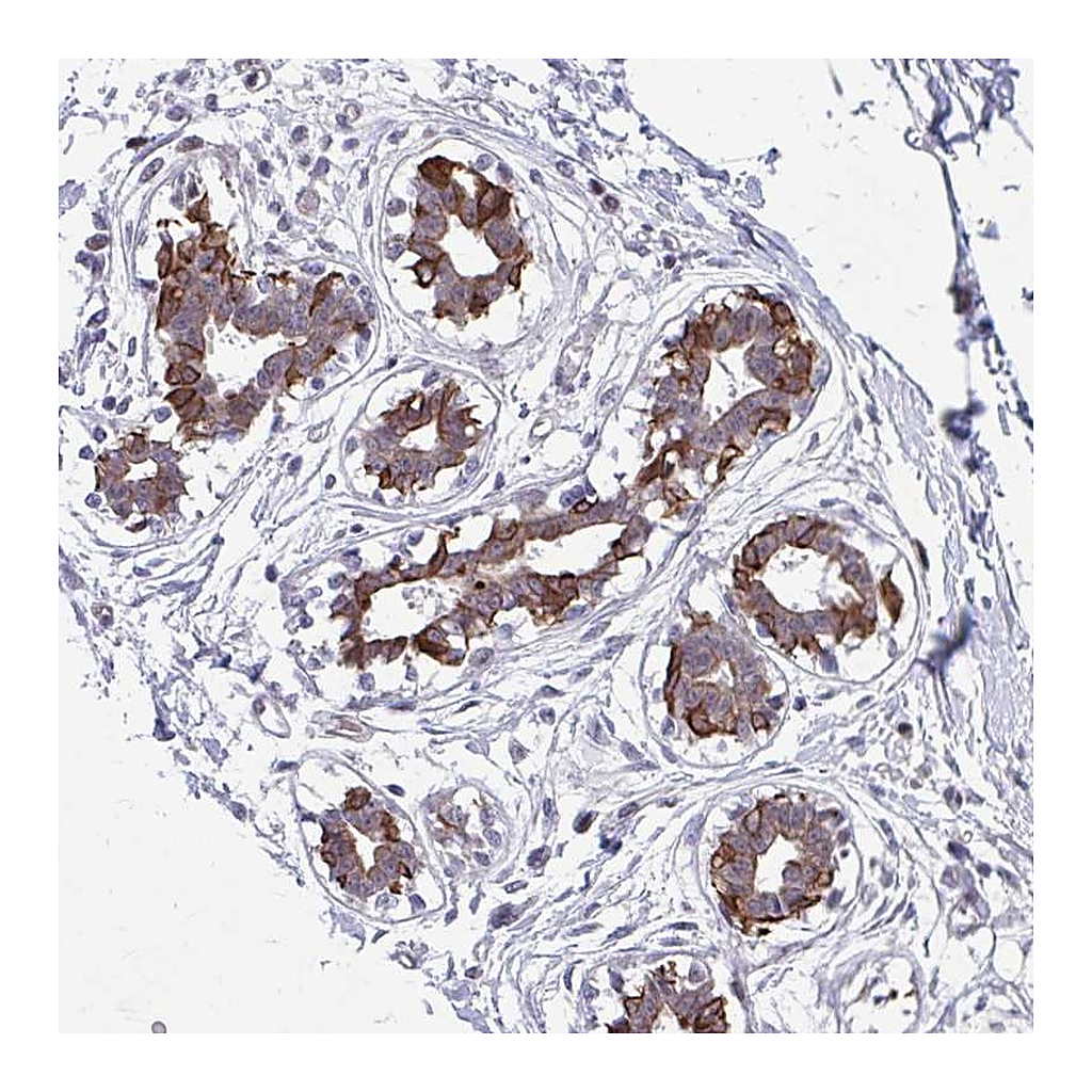 Atlas Antibodies Anti-ANKRD30B Antibody