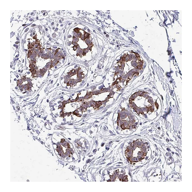 Atlas Antibodies Anti-ANKRD30B Antibody