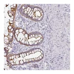 Atlas Antibodies Anti-ANKRD29 Antibody