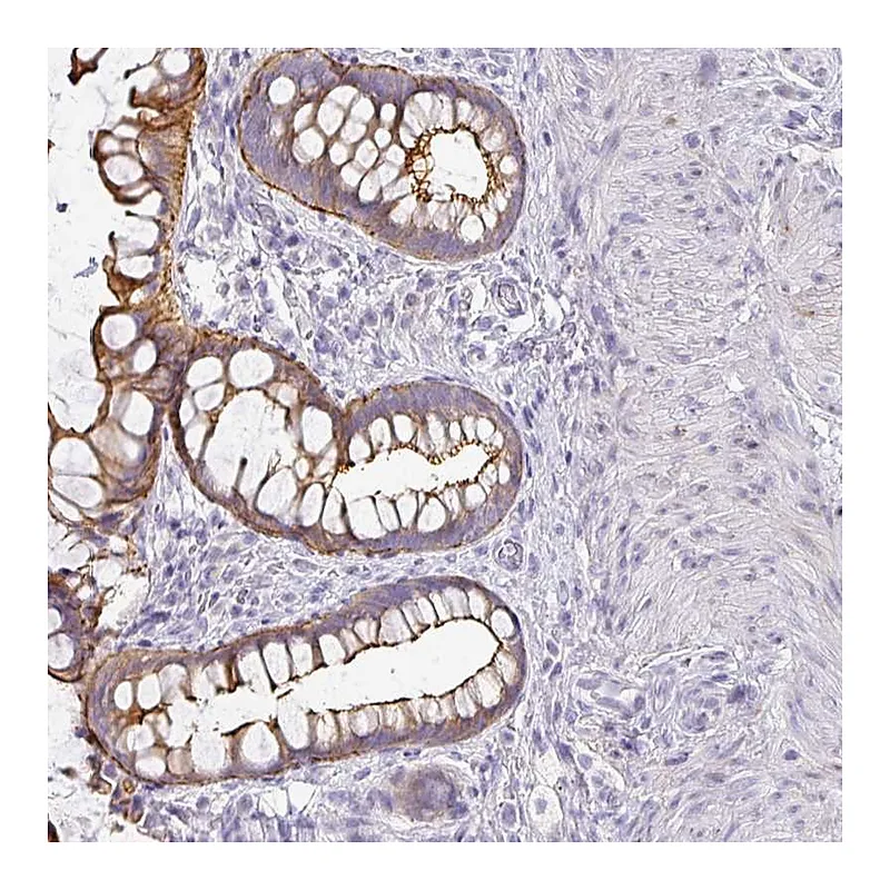 Atlas Antibodies Anti-ANKRD29 Antibody