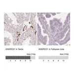 Atlas Antibodies Anti-ANKRD31 Antibody